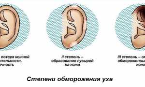 Что делать при обморожении уха?