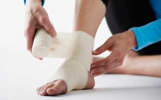 Как понять, почему болит нога после травмы: перелом, растяжение связок, разрыв связок, вывих, ушиб