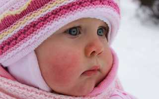 Что делать при переохлаждении и обморожении: первая медицинская помощь ребёнку