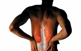 Растяжение мышц спины: что делать?